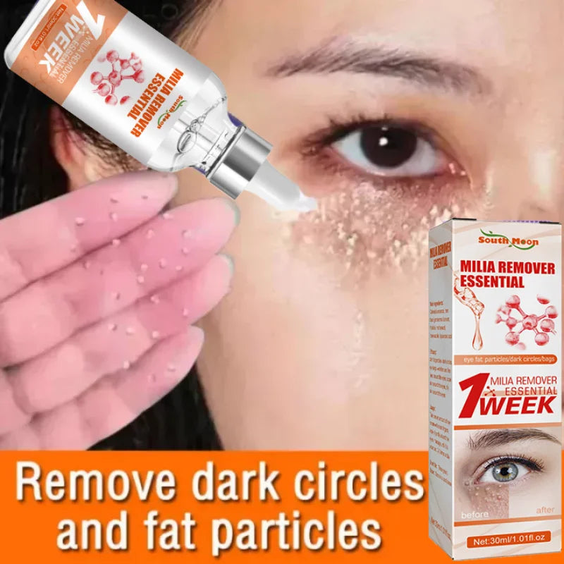 Fat Granules Removal Eye Serum Eye Milia Repair