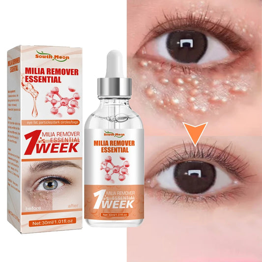 Fat Granules Removal Eye Serum Eye Milia Repair